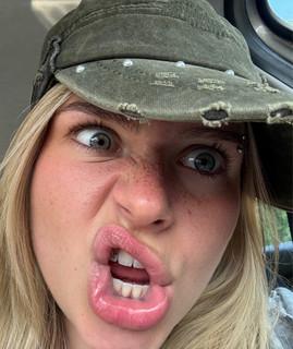 Y
